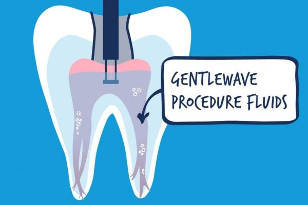 Gentle Wave Procedure Fluids